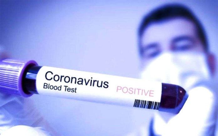 Kenali Beda Pneumonia dengan Virus Corona