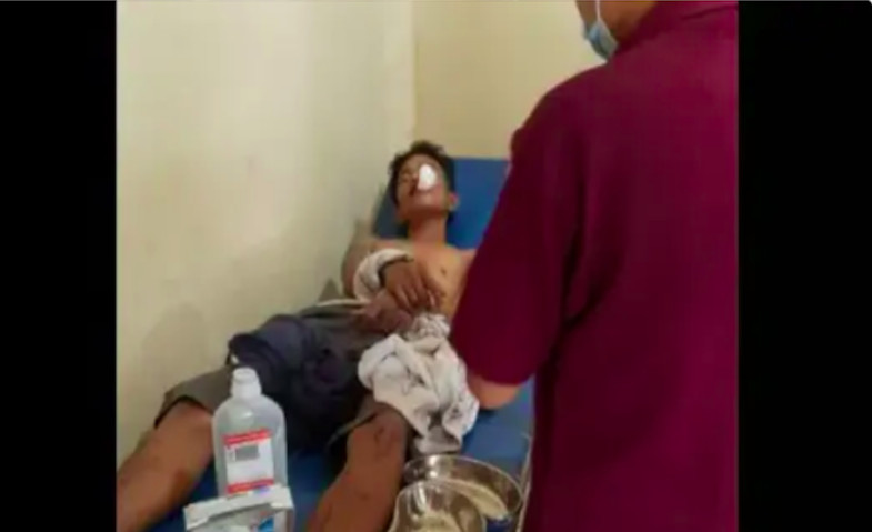 Pria Ini Nyaris Tewas, Usai Curi HP Anak