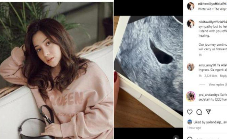 Hamil Anak Kedua, Nikita Willy Alami Keguguran